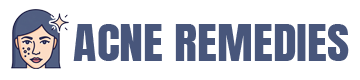 Best Acne Remedies